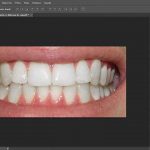 Cómo blanquear los dientes en Photoshop