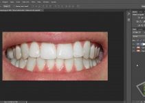 Cómo blanquear los dientes en Photoshop 6